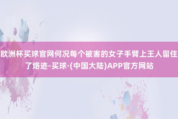 欧洲杯买球官网何况每个被害的女子手臂上王人留住了烙迹-买球·(中国大陆)APP官方网站